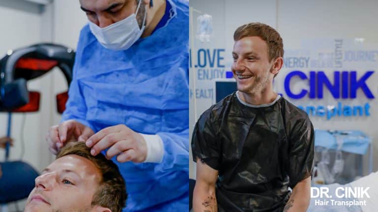 Ivan Rakitic's hair transplant: before-and-after photos and method used