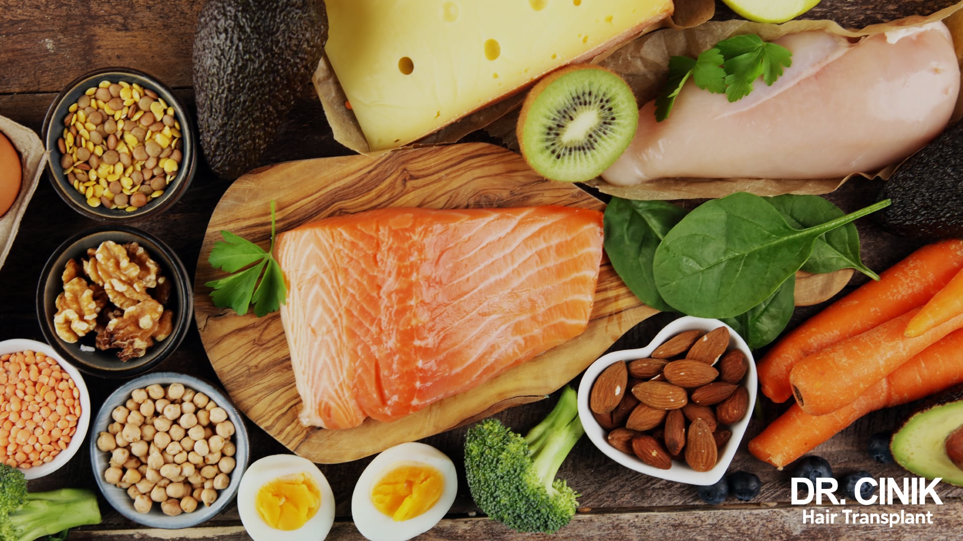 Banco di alimenti ricchi di proteine e ferro, salmone fresco, petto di pollo, uova sode, lenticchie, ceci, mandorle, noci, spinaci e carote