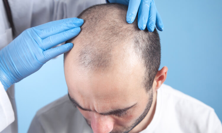 A man wants a revision or corrective hair transplant