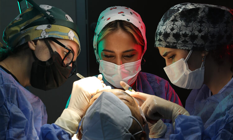hair transplant medical team implanting hair transplant