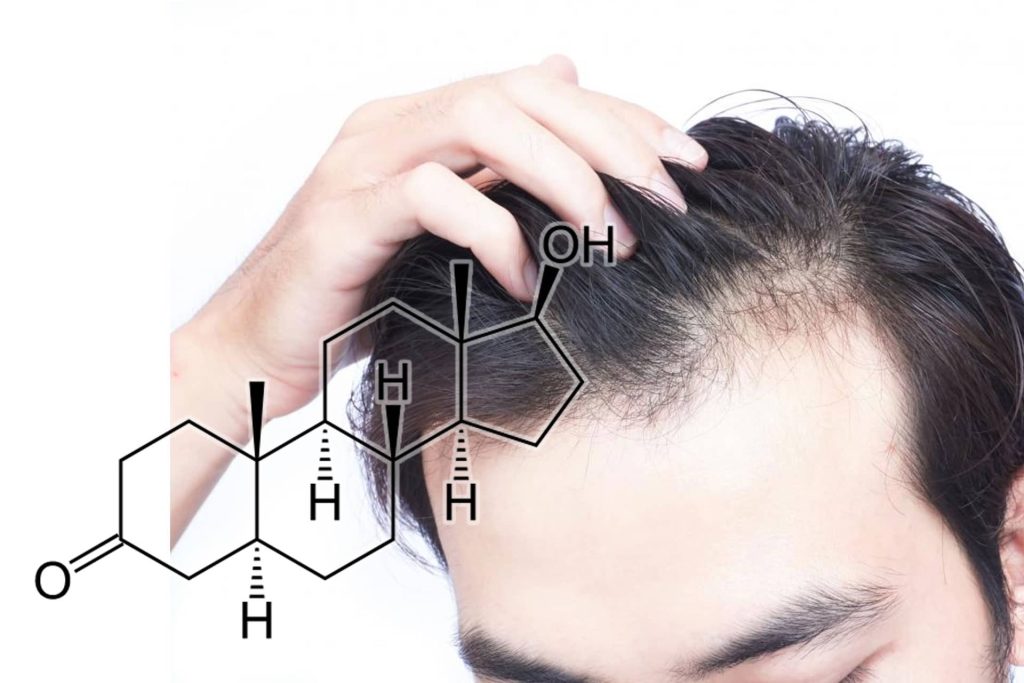 DHT e alopecia androgenetica: ruolo nella perdita dei capelli
