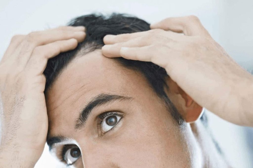 Caduta dei capelli: quando preoccuparsi e prendere provvedimenti