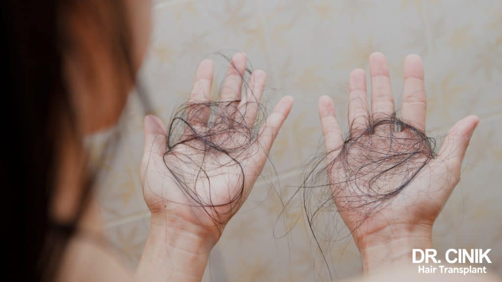 Une femme qui perd ses cheveux probablement à cause d’une alopécie post-ménopausique