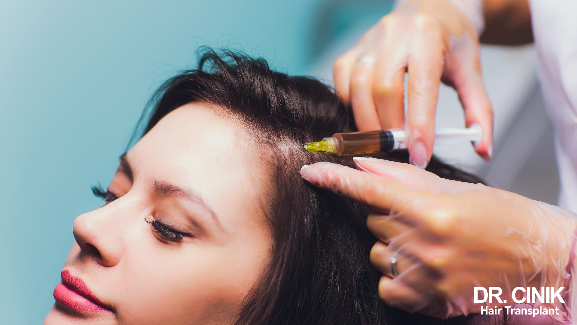 A woman is undergoing Platelet-Rich Plasma (PRP) therapy, a treatment designed to enhance hair growth
