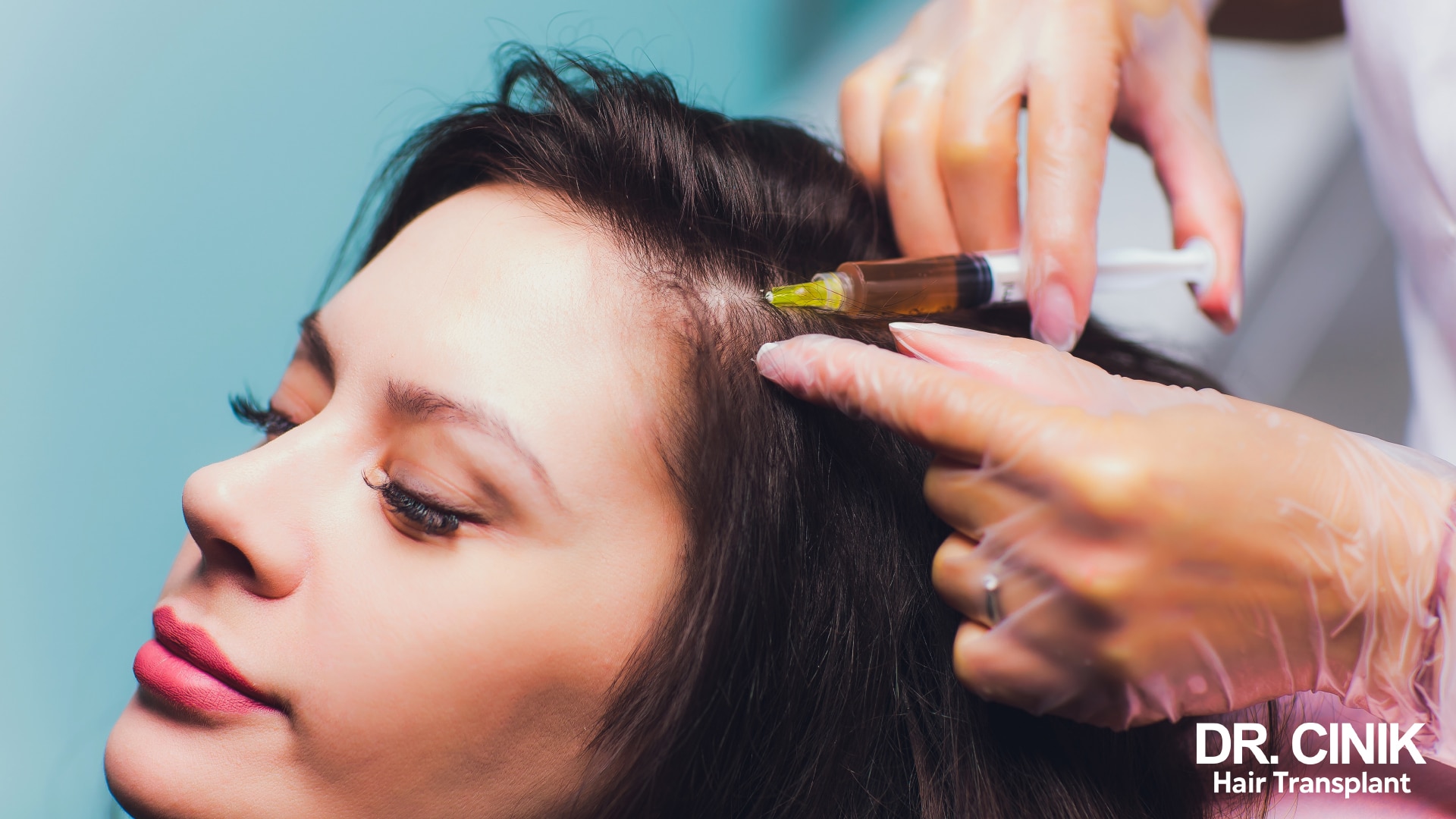 PRP hair treatment for female pattern hair loss
