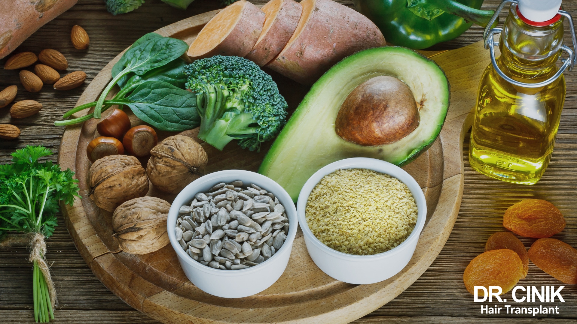 Aliments sains idéal pour ralentir la progression de l'alopécie androgéntique