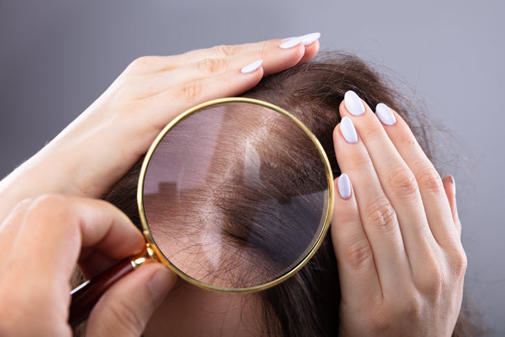 פתרון לשיער דליל אצל נשים