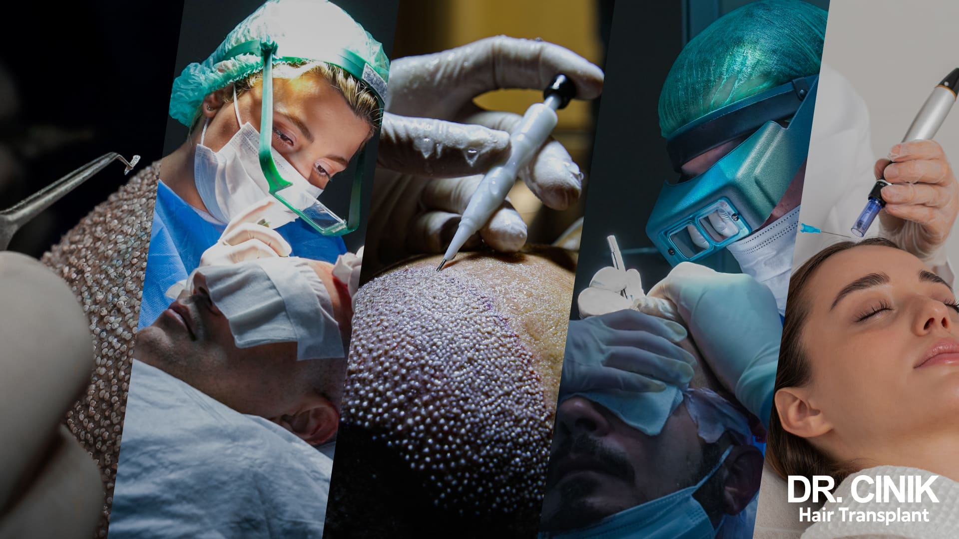 Dr Emrah Cinik, greffe de cheveux et soin capillaire