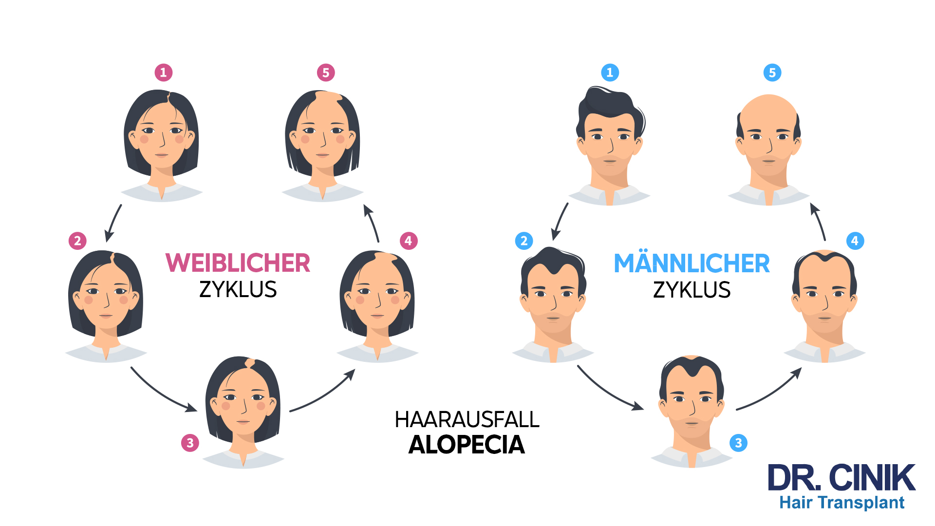 Auf der Grafik sind zwei Zyklen dargestellt: der "WEIBLICHER ZYKLUS" und der "MÄNNLICHER ZYKLUS". Im weiblichen Zyklus beginnt die Darstellung mit einer Frau mit vollen Haaren als Phase 1. Es folgt eine Frau mit leicht gelichteten Haaren in Phase 2, die dann in Phase 3 zu einer Frau mit sichtbarem Haarausfall führt. In Phase 4 wird eine Frau mit fortgeschrittenem Haarausfall gezeigt, und Phase 5 zeigt wieder die Frau aus Phase 1. Im männlichen Zyklus ist Phase 1 ein Mann mit vollen Haaren. In Phase 2 hat der Mann leicht gelichtete Haare, die in Phase 3 zu sichtbarem Haarausfall führen. Phase 4 zeigt einen Mann mit fortgeschrittenem Haarausfall, und Phase 5 zeigt wieder den Mann aus Phase 1. In der Mitte der Grafik steht "HAARAUSFALL ALOPECIA". Unten rechts ist das Logo "DR. CINIK Hair Transplant" abgebildet.