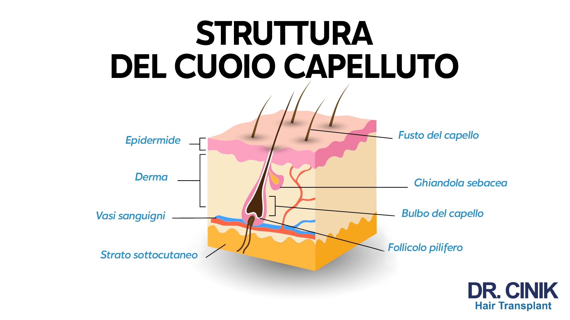 Un diagramma che mostra la "STRUTTURA DEL CUOIO CAPELLUTO" con didascalie in italiano. Partendo dalla parte superiore, sono etichettati l'epidermide, il fusto del capello, la derma, la ghiandola sebacea, i vasi sanguigni, il bulbo del capello, lo strato sottocutaneo, e il follicolo pilifero. Il logo "DR. CINIK Hair Transplant" è posizionato nell'angolo in basso a destra.