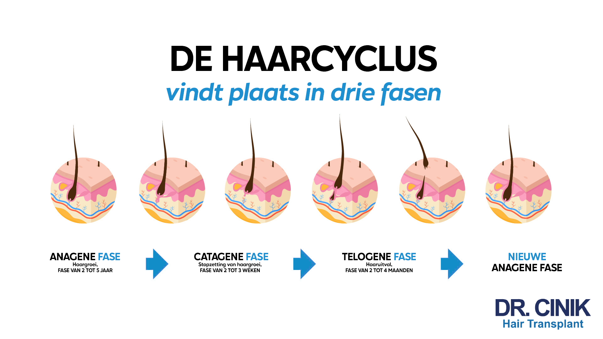 Een informatieve afbeelding die de drie fasen van de haarcyclus illustreert, gepresenteerd in het Nederlands. Bovenaan staat 'DE HAARCYCLUS vindt plaats in drie fasen'. Vier ronde, schematische afbeeldingen tonen de fasen van de haarcyclus met een enkele haarstreng in verschillende stadia van groei en rust. Van links naar rechts: 'ANAGENE FASE - Haargroei, FASE VAN 2 TOT 5 JAAR', 'CATAGENE FASE - Stopzetting van haargroei, FASE VAN 2 TOT 3 WEKEN', gevolgd door een pijl naar 'TELOGENE FASE - Haaruitval, FASE VAN 2 TOT 4 MAANDEN', en eindigend met 'NIEUWE ANAGENE FASE'. Onderaan staat 'DR. CINIK Hair Transplant'.