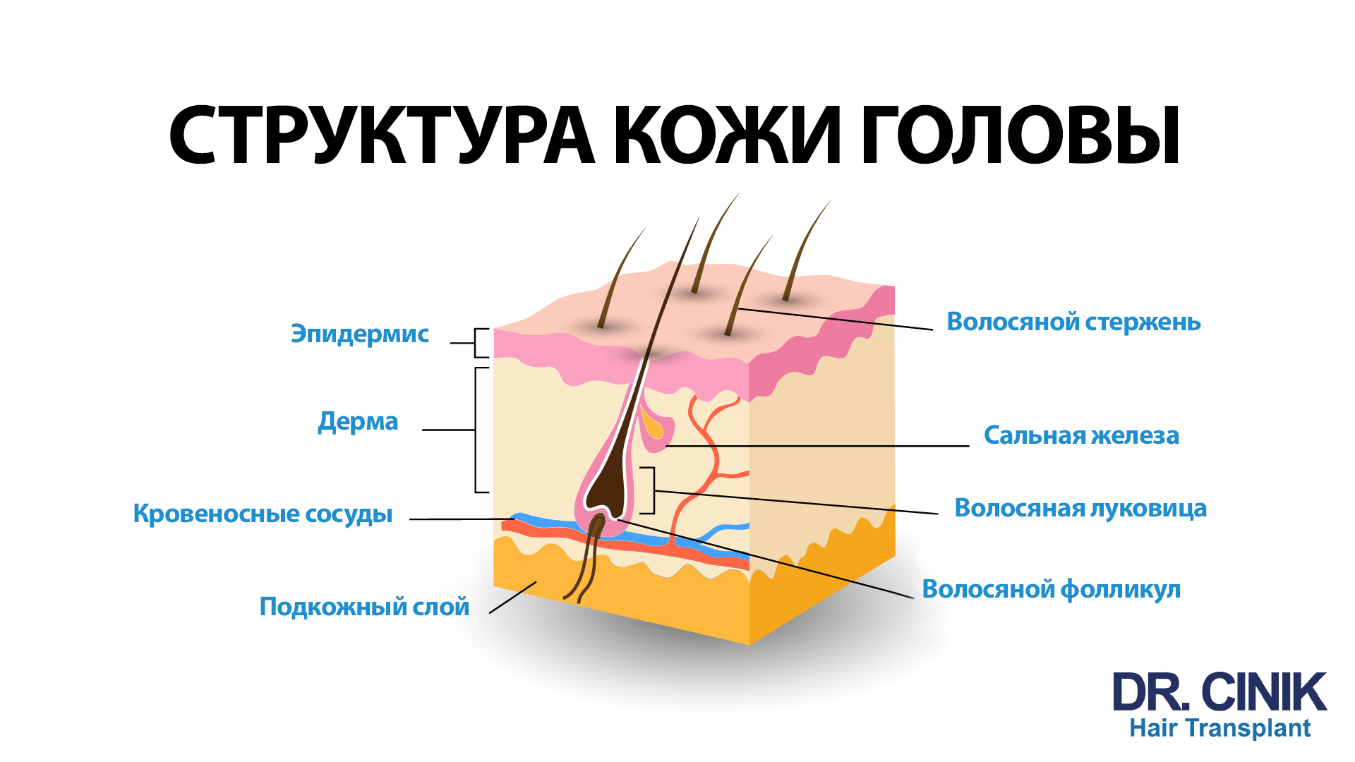 На изображении представлена детализированная диаграмма структуры кожи головы. На диаграмме изображен участок кожи в разрезе, где показаны различные слои: эпидермис, дерма, подкожный слой, а также кровеносные сосуды и волосяные фолликулы с луковицами. Каждый компонент подписан: волосяной стержень выходит из эпидермиса, сальная железа находится в дерме, а волосная луковица и фолликул находятся в нижних слоях. В верхней части изображения крупным шрифтом написано "СТРУКТУРА КОЖИ ГОЛОВЫ", а в нижней части - логотип "DR. CINIK Hair Transplant".